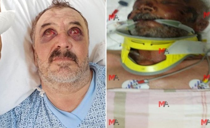 Helikopterden atılan köylülerin avukatları AYM’ye başvurdu