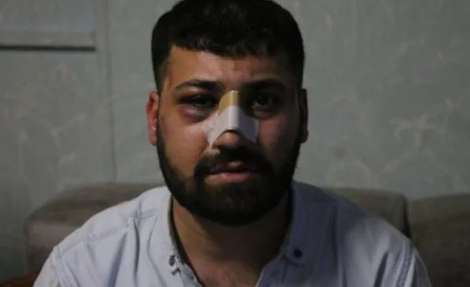 İşkenceden şikayetçi olan Harun Çapkan: Kürt olduğumuz için aşağılayıcı davranıyorlar, susmayacağım