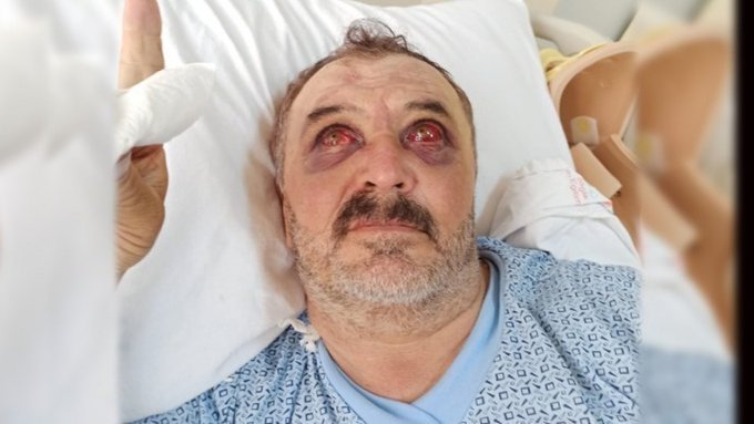 Yaşamını yitiren Servet Turgut ile birlikte helikopterden atılan Osman Şiban,  “Bir askerin helikopter yanında başıma tekme atması sonrası bayıldım. O andan sonrasını hatırlamıyorum” diyerek, askerler hakkında şikayetçi oldu.