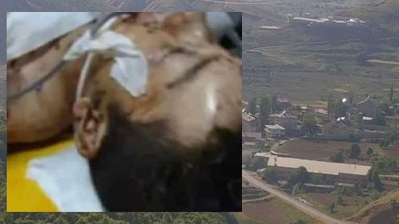 Yusuf Uluğ, koyunlarını otlattığı sırada askeri bir cismin patlaması sonucu ağır yaralandı